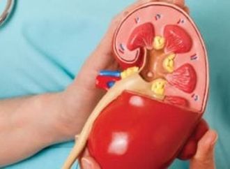 حصوات الكلى.. 3 طرق مدعومة علميا للوقاية منها