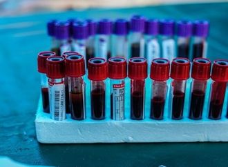 خمسة مؤشرات في الدم تكشف مشكلات صحية خطيرة