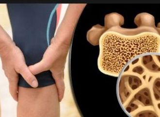 أعشاب طبية تعزز بناء العظام وتقلل خطر الهشاشة