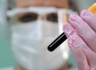 جدل منشأ كوفيد-19 يعود للواجهة.. دراسة تكشف مفاجأة في أصول الأوبئة