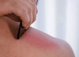 من فروة الرأس للظهر.. ترند الخربشة تجربة غير تقليدية للتخلص من التوتر
