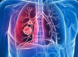 ما أعضاء الجسم الأكثر عرضة للإصابة بالسرطان؟..  اعرف طرق الوقاية