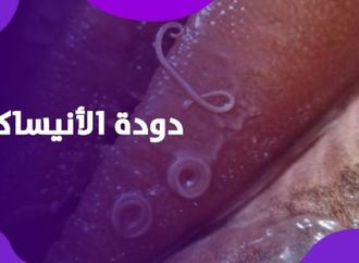 خطر غير مرئي داخل أسماك الرنجة… يمكن أن يسبب كارثة