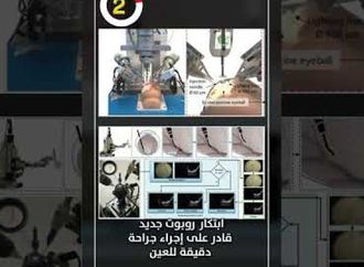 ابتكار روبوت جديد قادر على إجراء جراحة دقيقة للعين