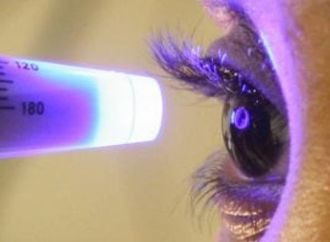 لماذ يطلق الأطباء على الجلوكوما اللص الصامت للبصر.. علامات مبكرة