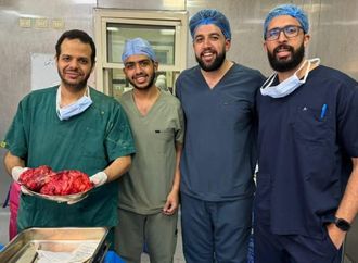فريق جراحة بقصر العيني يستئصل ورما نادرا يزن 9 كيلوجرامات من صدر مريض ستيني