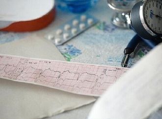 طبيب يوضح مخاطر اضطراب نظم القلب