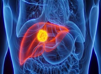 دراسة: الامتناع الكامل عن الكحول يعيد وظائف الكبد حتى في حالات التليف المتقدم