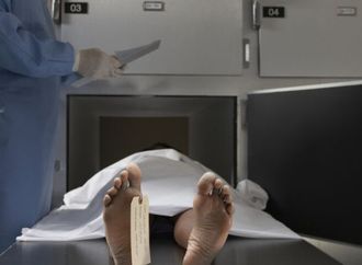 علاج كوري مثير للجدل يستخدم جلد المتوفين لتجديد البشرة