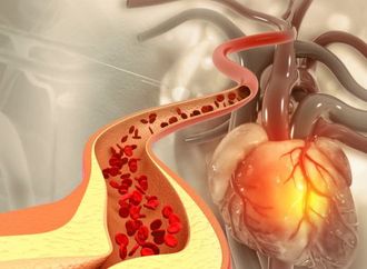 علامة صامتة حول العين قد تكشف خطر نوبة قلبية