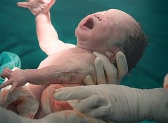 أبرزها زيادة معدلات التوحد.. "الصحة" تحذر من مخاطر الولادة القيصرية