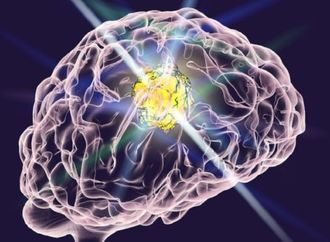 دواء فموي واعد ضد أورام دماغية عدوانية