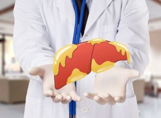 قبل أن يتفاقم الخطر.. هذه الأعراض البسيطة قد تكشف إصابتك بالكبد الدهني