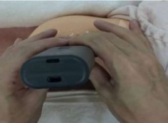 ابتكار فحص لحديثى الولادة باليابان للكشف عن مرض وراثى بالعظام