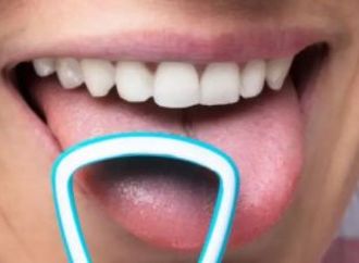 تسمم الدم.. توجه فورا للمستشفى اذا ظهرت هذه العلامة على لسانك