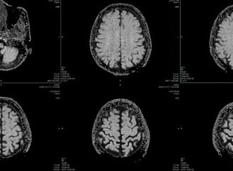 نصائح لحماية عقلك من مخاطر المستقبل والتفكير بذكاء أكبر في القرن الـ 21